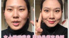 小眼睛 黑皮 明星,独特魅力闪耀荧屏